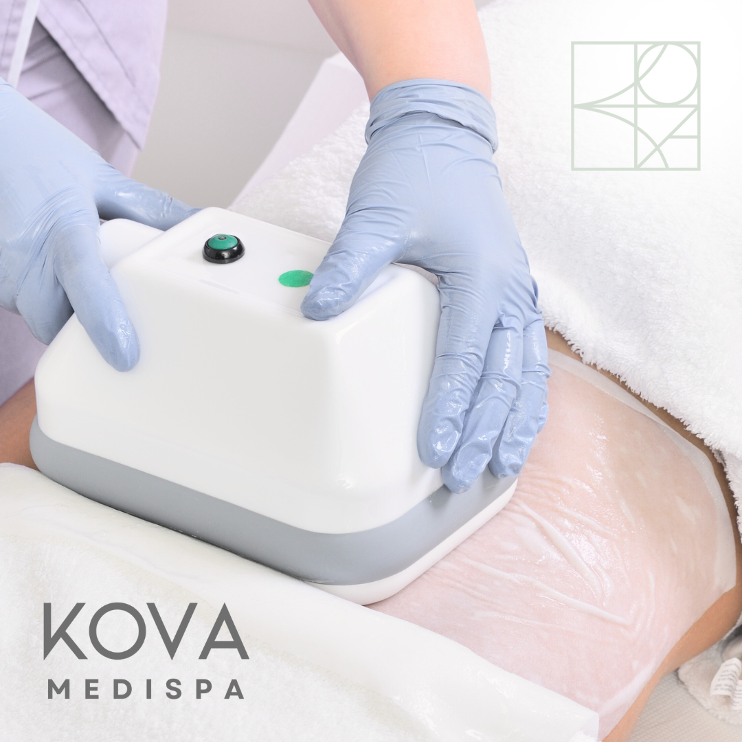 Cryo Fat Freeze