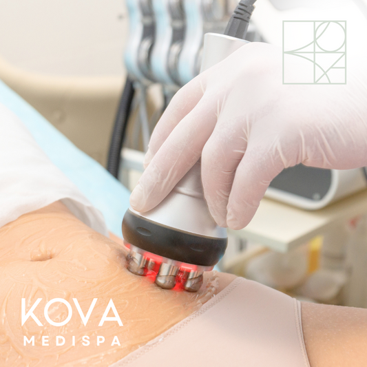 Radio Frequency (RF) Skin Tightening